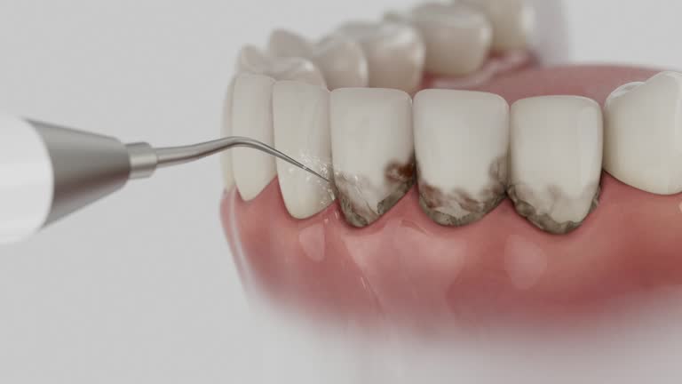 Trusted Teeth Cleaning And Checkup service in Rome, NY - Dentist Open Now